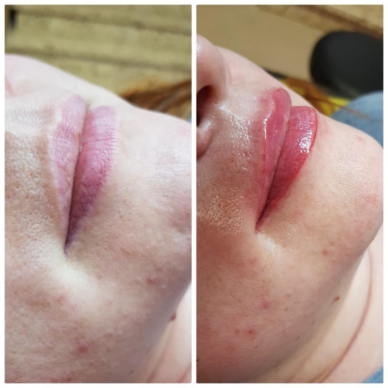 Lippen
